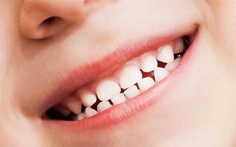 Wie Graz Kinderzähne schützt